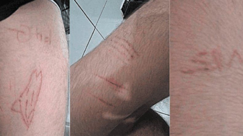 Una de las pruebas consiste en provocarse cortes en los brazos dibujando una ballena. En otra hay que subir a un lugar alto y mirar al precipicio.