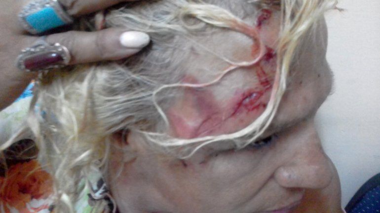 Mamucha Ramírez sufrió una brutal agresión el martes a la noche. Terminó con un corte en la cabeza, una costilla quebrada y varios dientes flojos.