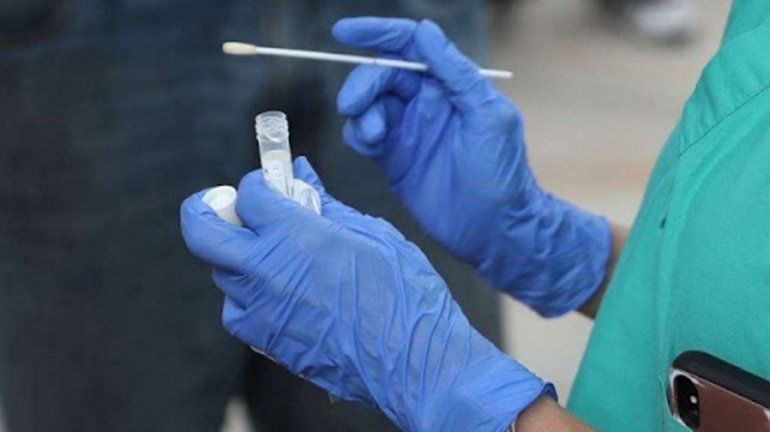 Diagnosticarán positivos de coronavirus sin hacer los hisopados
