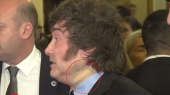 El misterio de la venda en el cuello: por qué apareció lesionado Javier Milei