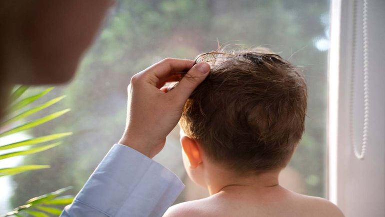 Paraguayos ofrecen plata a niños de la región a cambio de su pelo