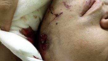 el policia cargo la escopeta, se la apoyo en la cara y le disparo el policia cargo la escopeta, se la apoyo en la cara y le disparo