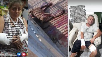 un pitbull ataco a ocho personas y la policia termino matandolo