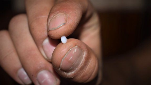 San Antonio: comía una almeja y encontró una perla