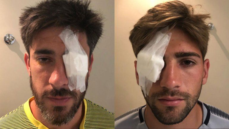 Cómo quedaron los jugadores Pérez y Lamardo tras los incidentes