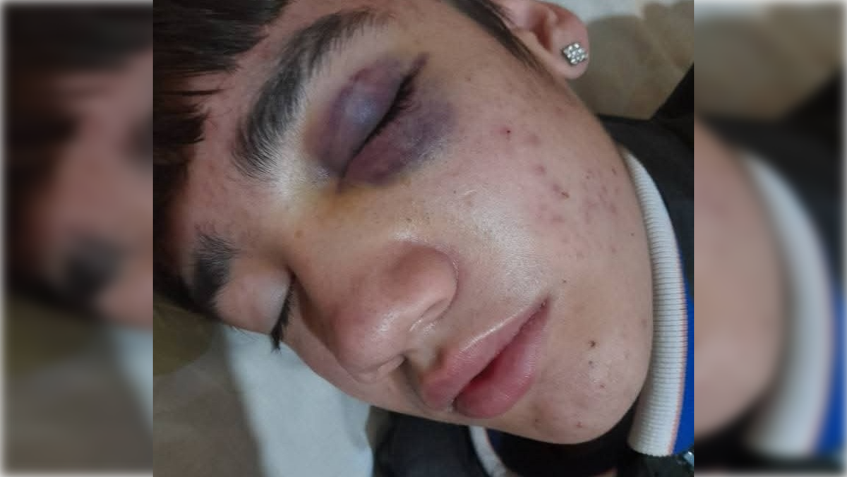 El joven de 14 años fue atacado por tres personas. La madre realizó la denuncia. Foto: gentileza Seny Radio.