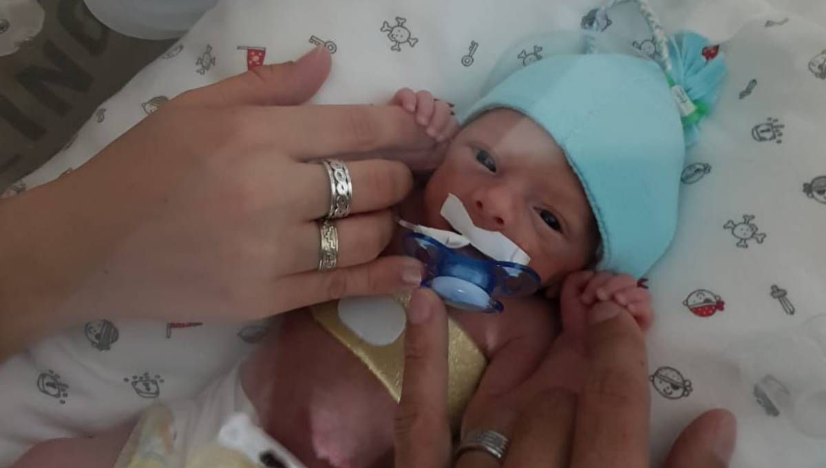 Oti nació con apenas un kilo. Recibió leche humana donada durante el primer día fuerza de la panza.