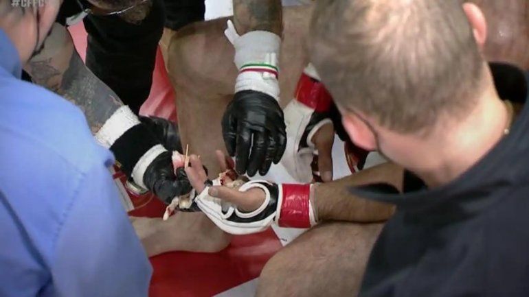 El desgarrador momento que vivió el peleador.