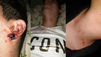 victimas de la golpiza no pudieron reconocer a sus atacantes