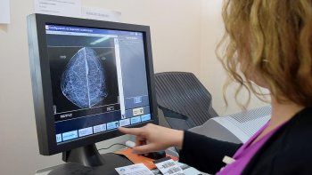 capacitaran en el diagnostico de cancer de mama en cipolletti