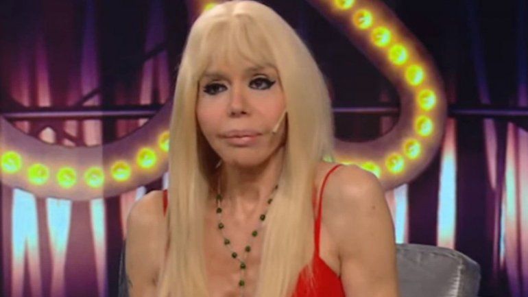 Adriana Aguirre dio detalles escalofriantes del accidente que sufrió