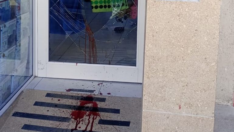 El ladrón rompió el vidrio de una patada con la pierna derecha. Pero se lastimó con el filo del cristal y tuvo que reperir atención en el hospital. 