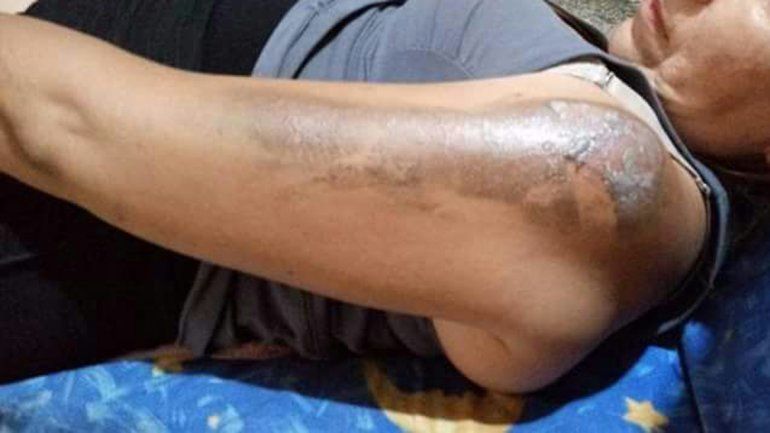 La mujer agredida por el chino sufrió lesiones en varias partes del cuerpo.