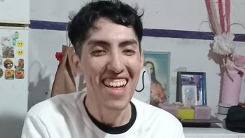 Trapecista rionegrino sufrió un grave accidente en un circo