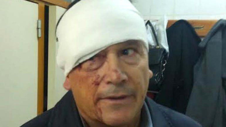 El comisario Antonio Mandagaray fue herido por dirigentes de ATE.