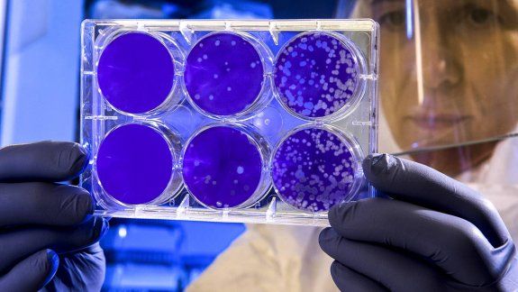Descubren mutaciones del coronavirus en Argentina