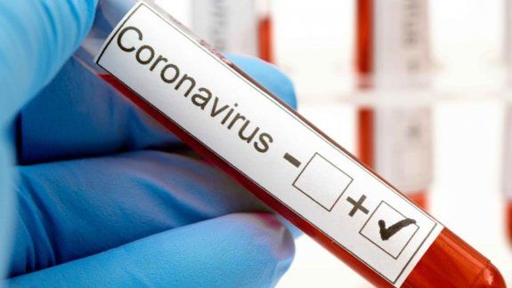 Coronavirus: Río Negro registró dos nuevos casos positivos