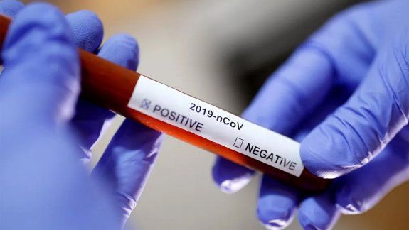 Científicos revelaron todo lo que se sabe sobre el coronavirus