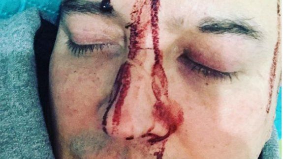 Leo García sufrió un brutal ataque homofóbico 
