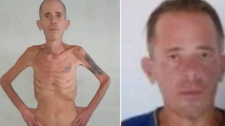 La imagen del opositor tras su liberación vuelve a poner el foco en las denuncias sobre las condiciones en cárceles de Cuba.