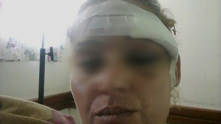 La mujer quedó con la cara desfigurada tras la brutal agresión de su pareja.