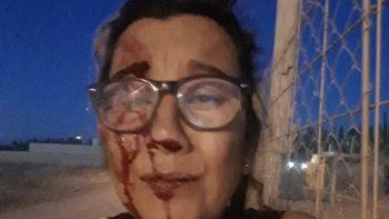 una joven huyo para que su ex pareja no la asesine 