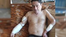 Luis García, el vecino del barrio Martín Fierro. Sufrió serias heridas por el ataque de cuatro perros. 