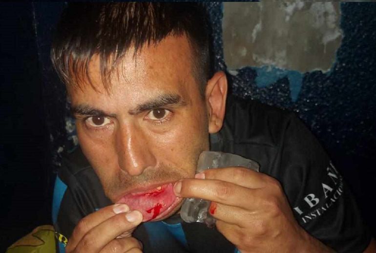 Graves agresiones a Deportivo Rincón en Comodoro Rivadavia y partido suspendido