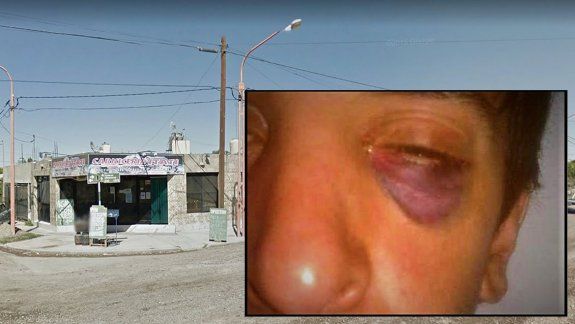 El joven de Oro atacado brutalmente por motochorros fue operado del ojo y salió bien