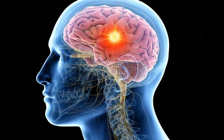 Muchas patologías pueden prevenirse o reducir su impacto mediante hábitos saludables.
