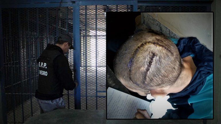 Brutal ataque a un preso cipoleño en la cárcel de Roca