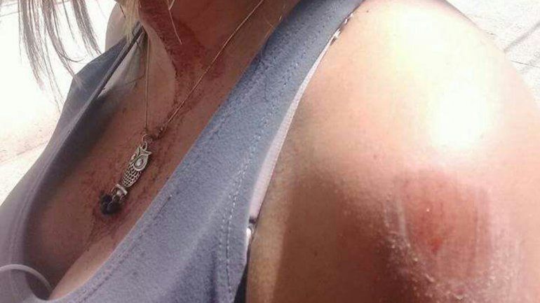 La mujer agredida por el chino sufrió lesiones en varias partes del cuerpo.