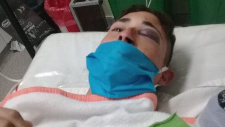 Se recupera el joven que se fracturó el cráneo tras tirarse al canal de El 30