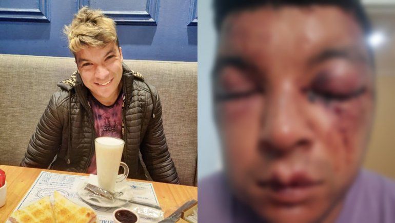 Brutal golpiza a un cipoleño: Fue un ataque homofóbico