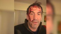 robo a pablo cervi y su familia: los detalles del violento asalto robo a pablo cervi y su familia: los detalles del violento asalto