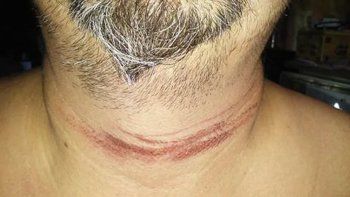 iba en moto y casi muere decapitado por un cable