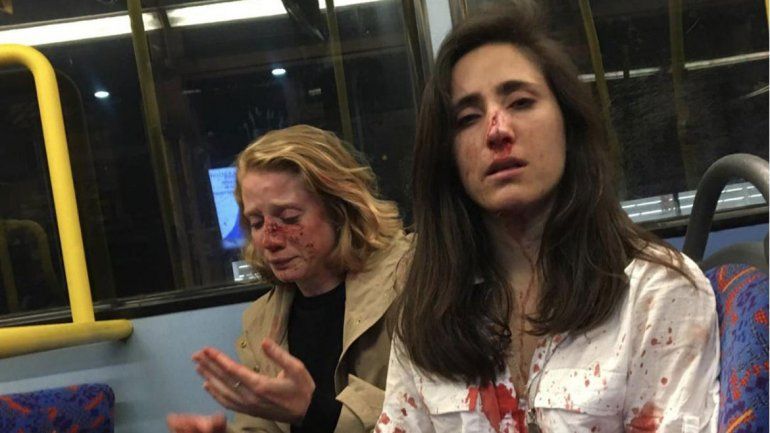 Brutal golpiza en un micro a una azafata uruguaya y a su novia