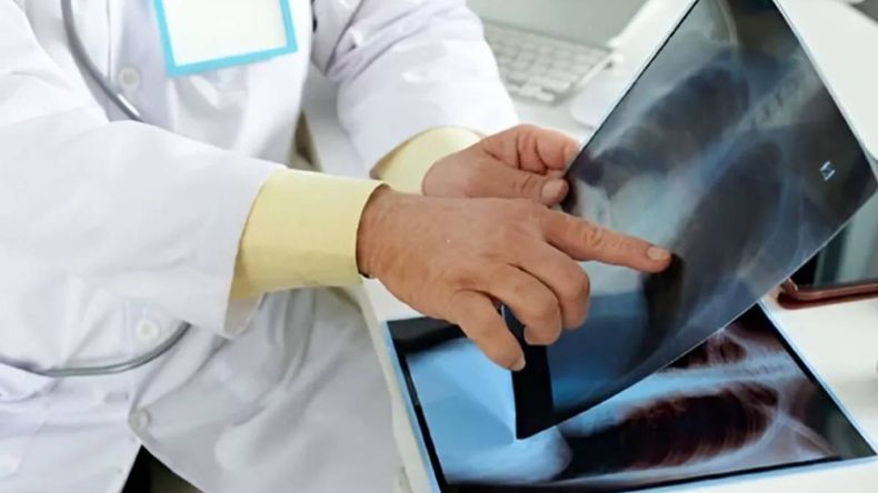 Alerta tuberculosis: siguen en aumento los casos y refuerzan la entrega de medicamentos