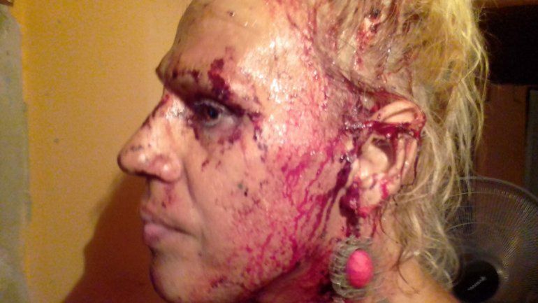Mamucha sufrió graves heridas en el marco de la guerra trans.