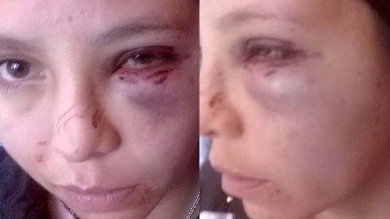 Brutal golpiza de un hombre a su pareja en el barrio Don Bosco: la pateó hasta dejarla inconsciente