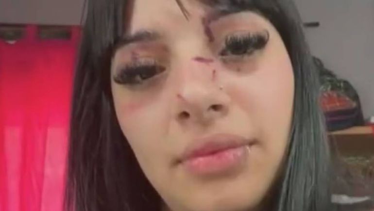 Las heridas en su rostro luego del ataque.&nbsp;