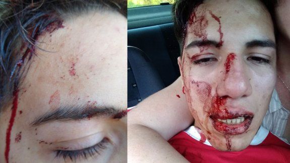 Joven denunció que un taxista le dio un brutal piedrazo en la cara