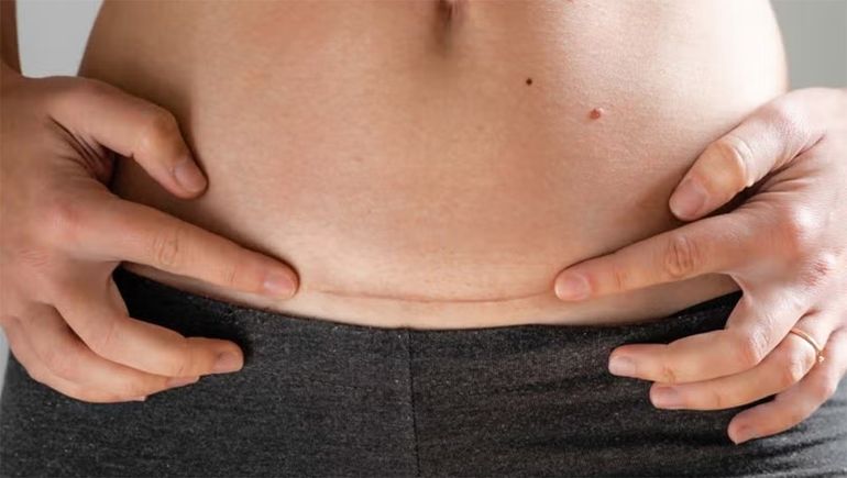 Condenaron a una clínica privada y a un anestesista por violencia obstétrica