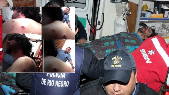 Denuncian brutalidad policial para detener a un hombre: recibió siete balazos de goma