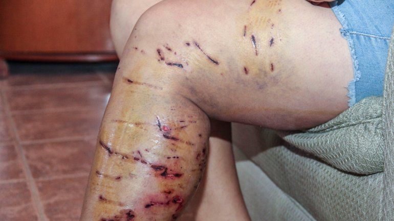 Candelaria fue brutalmente atacada por cuatro perros en el barrio Labraña