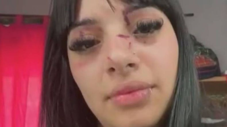 Las heridas en su rostro luego del ataque. 