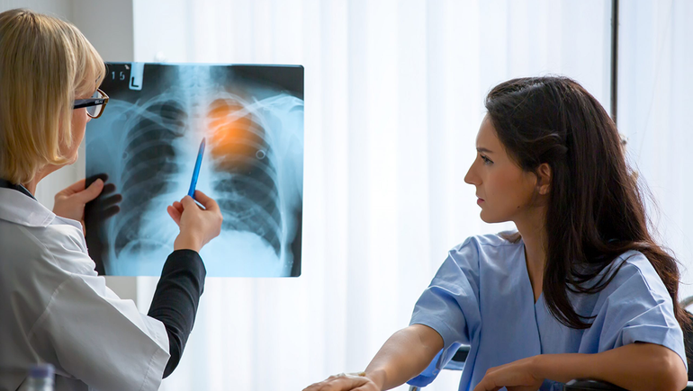 Se conocen avances para tratar el cáncer de pulmón