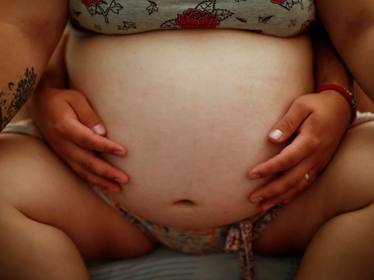 Cirugía estética sobre una cicatriz la dejó peor que antes