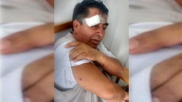 Un periodista cipoleño recibió dos balazos de goma durante una cobertura en Neuquén