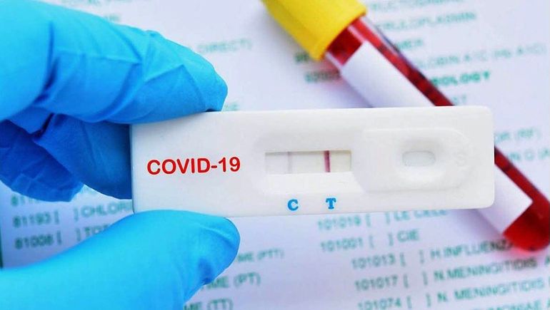 Los autotest de COVID costarán $1900 en las farmacias